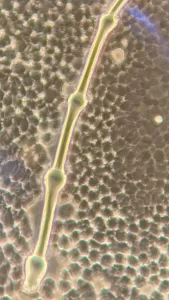 Aspergillus Mold and the ‘Corona Effect’ in the Blood!